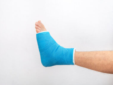 Man's leg in plaster cast and blue splint close up on white background. Gipsfuß